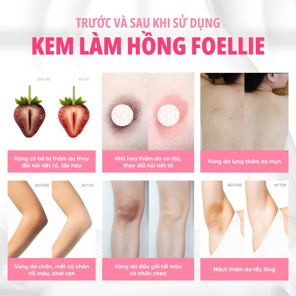 Foellie Việt Nam